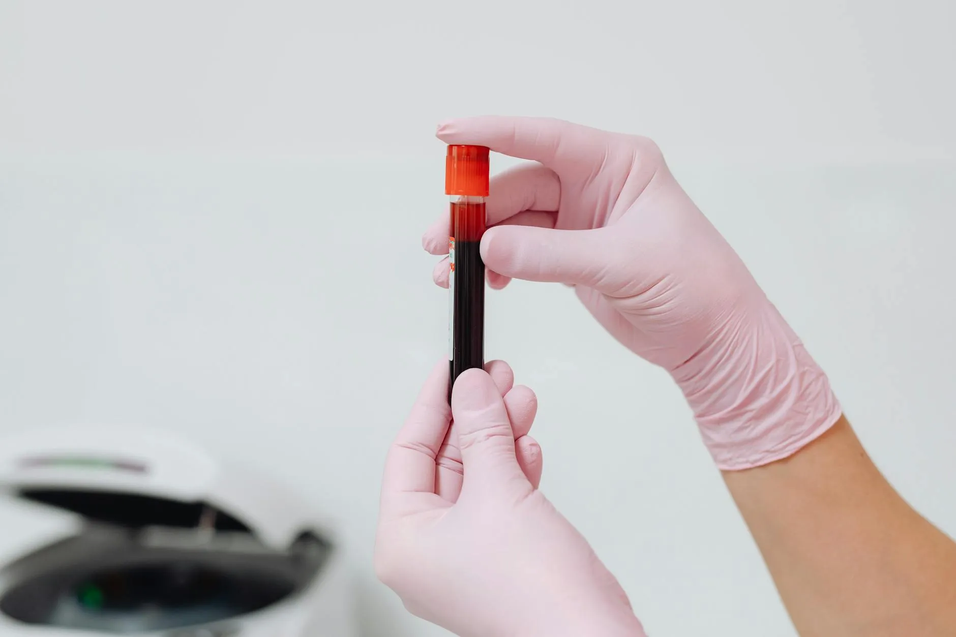 Et tæt billede af handskeklædte hænder, der holder en blodprøve i et test-/reagensglas. Velegnet til artikler om laboratoriearbejde, prøvetagning og sundhedsforskning.