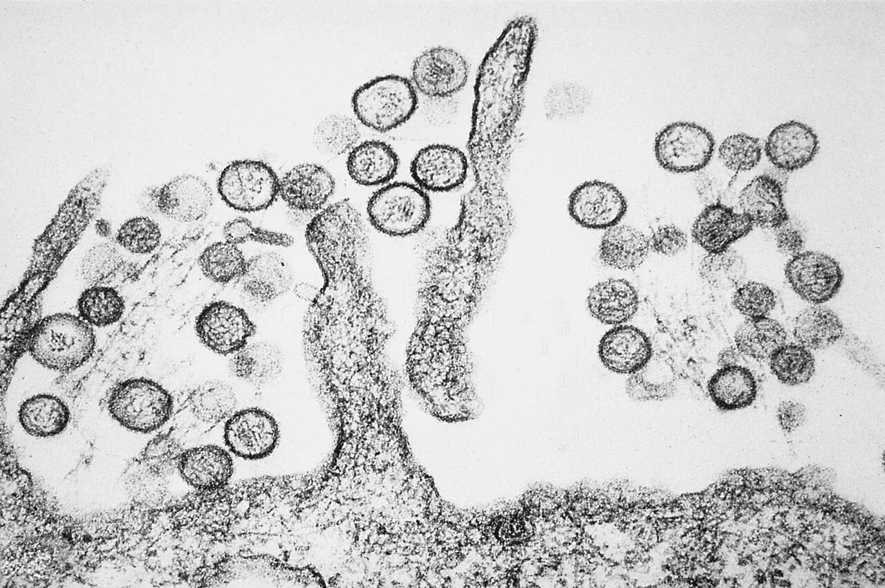 Transmissionselektronmikrografi af Sin Nombre-hantavirus. Hantavirus kan i sjældne tilfælde give hantavirus-lungesyndrom (HPS) efter smitte via gnaveres efterladenskaber.