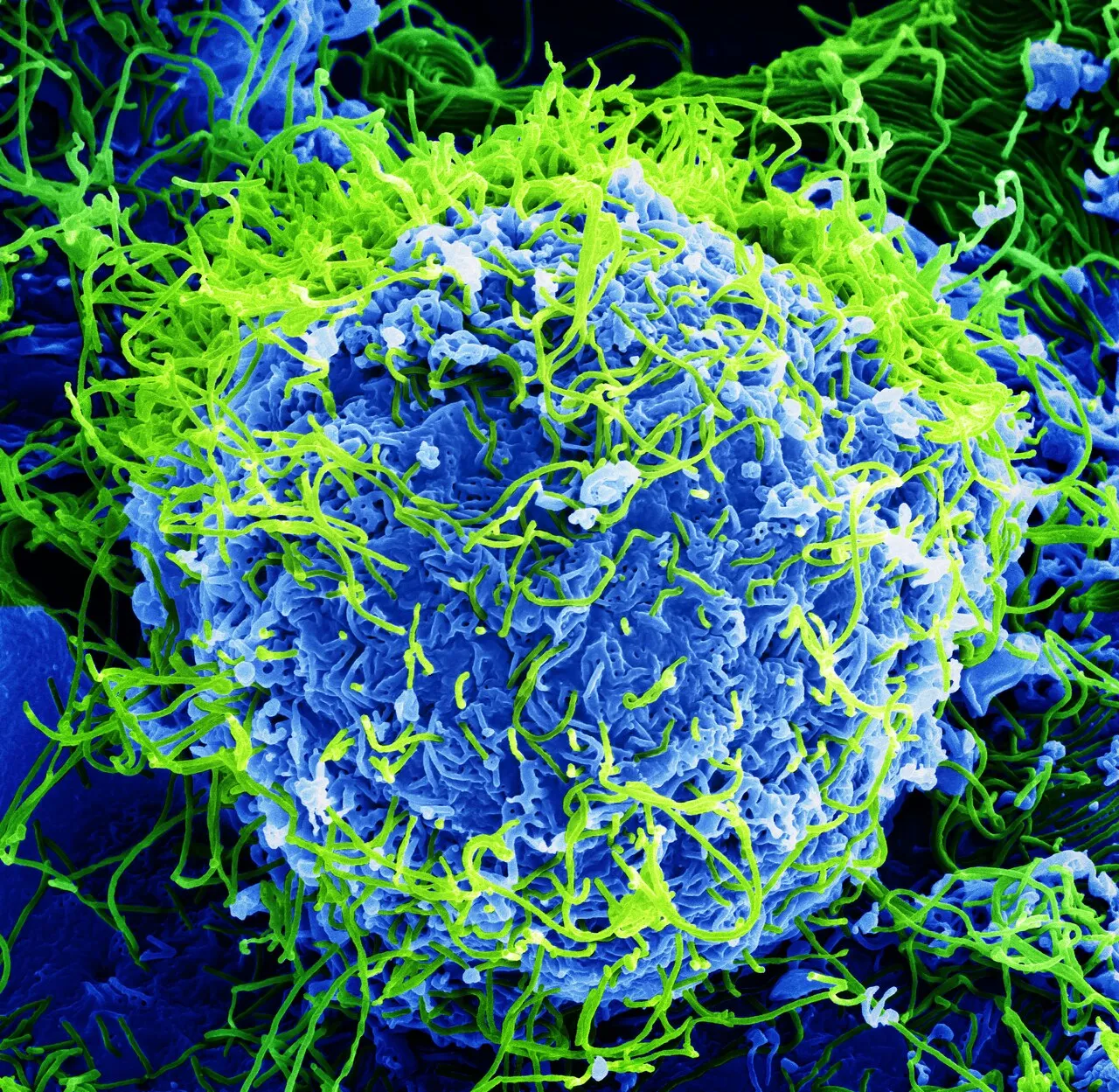 Farvelagt scanning elektronmikroskopi af Ebola-viruspartikler (grønne) både som fritliggende partikler og som spirende partikler fra en inficeret celle (blå). Billedet er taget ved ca. 20.000x forstørrelse.