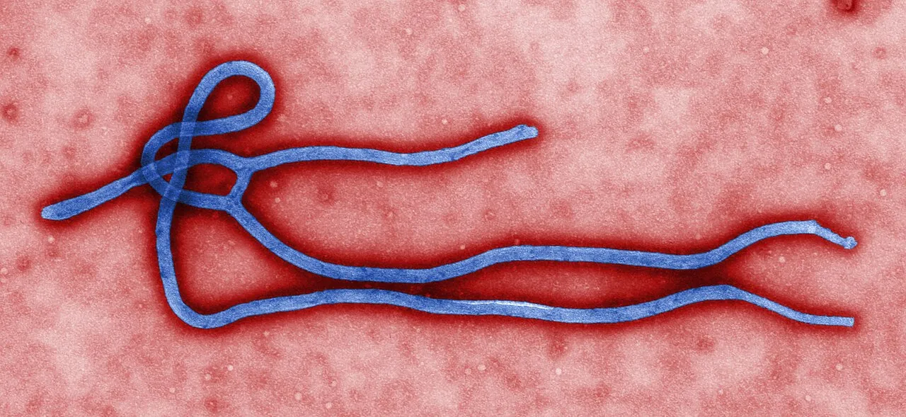 Farvelagt transmissionselektronmikroskopi (TEM) af en Ebola-viruspartikel (virion). Billedet viser virussets ultrastrukturelle form.