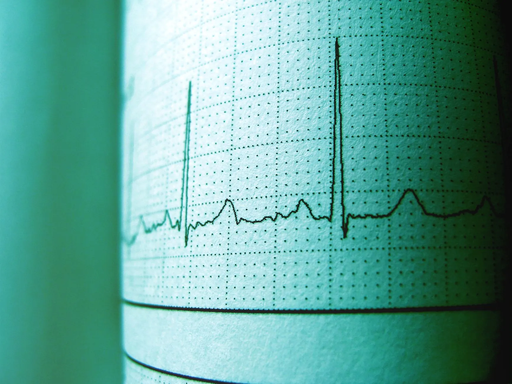 Et close-up af et EKG-print viser en hjerterytme og målinger til medicinsk vurdering. Det understreger diagnostik og sundhedsovervågning.