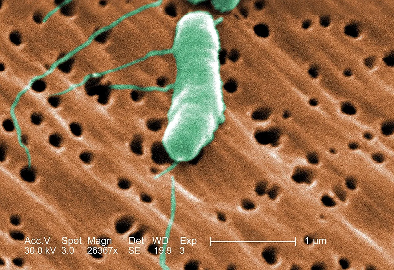 Farvelagt scanningselektronmikroskopi (SEM) af bakterien Vibrio vulnificus med tydelige flageller. Billedet illustrerer mikroorganismens overflade og struktur.